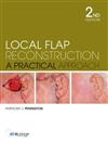 Local Flap Reconstruction