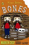 Bones