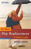 All About Hip Replacement: A Patient's Guide
