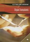 Organ Transplants