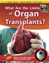 What Are the Limits of Organ Transplants?